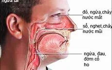 Cẩn thận với những bệnh dị ứng hay gặp