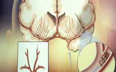 Trà thuốc cho người tăng huyết áp