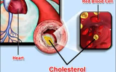 Thận trọng với thuốc hạ mỡ máu nhóm statin