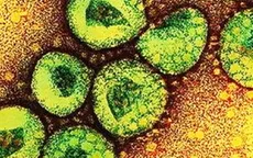 Pháp: Thêm 2 bệnh nhân nghi nhiễm virus mới gần giống SARS