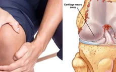 Bệnh khớp gối - Chớ coi thường!