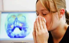 Bài thuốc điều trị viêm xoang hiệu quả