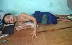 Người đàn ông hơn 30 năm chỉ sống trên giường