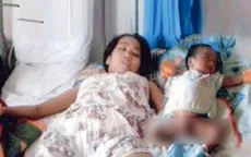 Mẹ đau đớn phải cắt chân, con khóc lả vì khát sữa