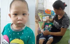 Cháu bé 2 tuổi bị bỏ rơi với căn bệnh đa dị tật bẩm sinh