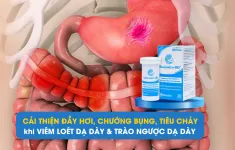 Cải thiện đầy hơi, chướng bụng khi mắc viêm dạ dày, trào ngược dạ dày thực quản