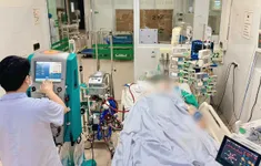 Thay huyết tương, sử dụng ECMO cứu người phụ nữ đồng mắc lao và lupus ban đỏ