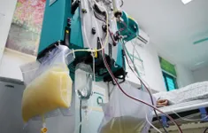 Sở Y tế TP Hồ Chí Minh: Mở rộng chỉ định lọc máu, lọc huyết tương cần phải dựa trên chứng cứ khoa học