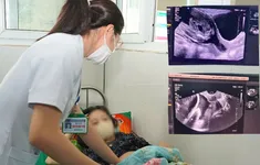 Khâu eo cổ tử cung giữ thai 22 tuần cho sản phụ