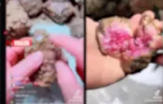 Bẫy lừa đảo "đổ thạch" trên mạng xã hội