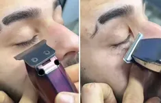 Hiểm họa tiềm ẩn từ trào lưu cạo sạch lông mi của nam giới