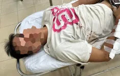 Bắt đối tượng truy nã khi xử lý tai nạn giao thông