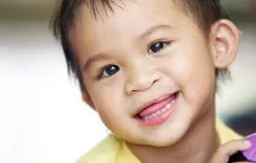 Khám sàng lọc và phẫu thuật miễn phí cho trẻ em khuyết tật tại Cao Bằng