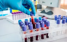 Hơn 40% người Việt có cholesterol máu cao