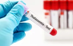 Ngày Thalassemia Thế giới 2025: Chung tay vì một thế hệ khỏe mạnh