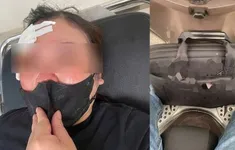 Dùng gậy sắt chọc vào mặt người phụ nữ do mâu thuẫn giao thông ở Hà Nội