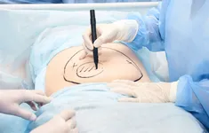 Yêu cầu Bệnh viện Đa khoa Gia Định tạm ngưng phẫu thuật hút mỡ bụng