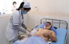 Sức khỏe 12 nạn nhân vụ nổ máy phủ ở Quảng Nam cơ bản ổn định