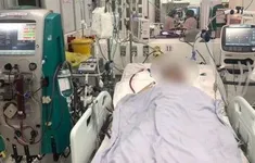 Ứng dụng ECMO cứu sống người bệnh viêm cơ tim cấp nguy kịch