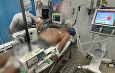 Hơn 60 phút ép tim, giành lại sự sống cho bệnh nhân nhồi máu cơ tim