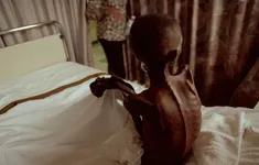 Mỗi phút, thêm một người chết vì HIV/AIDS