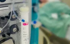 Thay huyết tương cứu sống bệnh nhân suy gan cấp