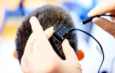 Đột phá thiết bị cấy ghép não AI giúp người câm nói và hát