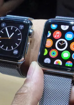 Vlogger Việt tung video hài hước chê bai "siêu phẩm" Apple Watch