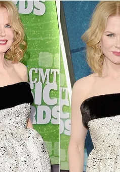 CMT Awards 2015: Nicole Kidman khoe mặt "cứng đờ" như tượng sáp