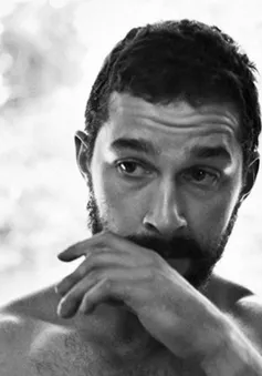 Shia LaBeouf vỡ đầu, phải khâu 20 mũi vì phim mới?