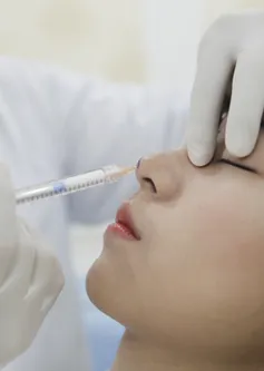 Làm đẹp bằng chất làm đầy filler -  Coi chừng “tiền mất, tật mang”