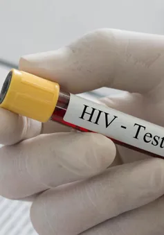 Anh chữa thành công ca nhiễm HIV đầu tiên trên thế giới?