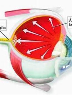 Dấu hiệu nhận biết và phương pháp điều trị bệnh glocom