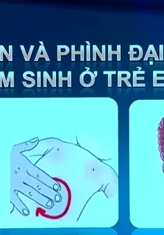 Tìm hiểu táo bón và bệnh phình đại tràng bẩm sinh ở trẻ em