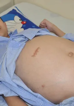 4 lần mổ não, tính mạng cậu bé 10 tuổi như ngọn đèn trước gió