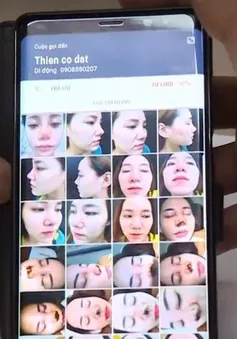 Tràn lan cơ sở tiêm filler, botox chui