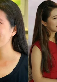 Cô gái nghèo và hành trình lấy lại nhan sắc