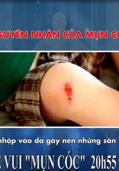Khỏe Vui: Bệnh "mụn cóc" (20h55 thứ Bảy, 31/3)
