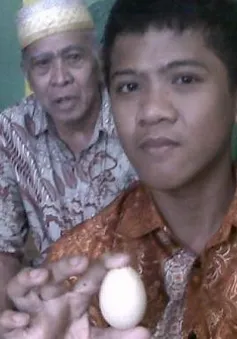 Ly kỳ câu chuyện cậu bé người Indonesia "đẻ" trứng trong hai năm
