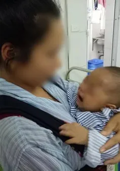 Trẻ 7 tháng tuổi phải khoét bỏ mắt vì mẹ nhỏ sữa chữa đỏ mắt
