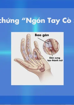 "Khỏe - Vui: Ngón tay cò súng" (20h55, thứ Bảy, 27/1)