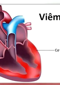 Bộ Y tế khẳng định: Không ghi nhận chủng virus "mới, lạ" gây viêm cơ tim