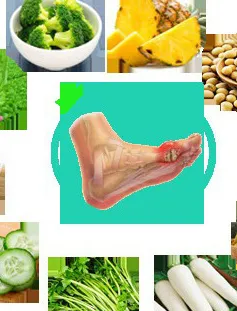 Dinh dưỡng hợp lý cho người mắc bệnh gout trong dịp Tết