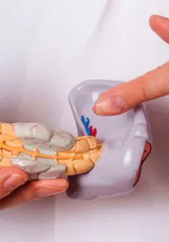 Thuốc làm tiêu biến khối u ung thư tuyến tụy trong 14 ngày