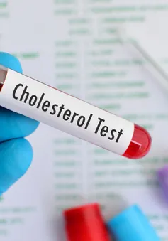 Lợi ích của điều trị sớm tình trạng cholesterol cao