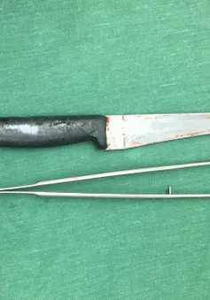 Người đàn ông vào viện với con dao găm dài 20cm găm thấu vai