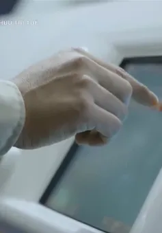 Làm thế nào để giảm thiểu rủi ro và bảo vệ thương hiệu khi kinh doanh nhượng quyền?
