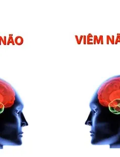 Nhiều trẻ bị viêm màng não, viêm não Nhật Bản biến chứng