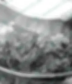 Người phụ nữ phải ngủ ngồi vì khối u trung thất nặng 2kg