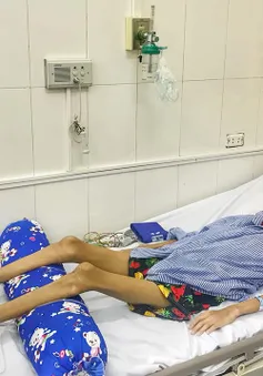 Thiếu niên 15 tuổi bị nấm phổi xâm lấn gây suy kiệt cần giúp đỡ